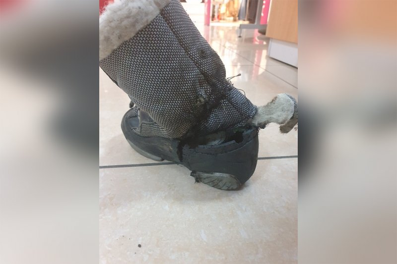 В торговом центре Красногорска ногу ребенка "зажевал" эскалатор