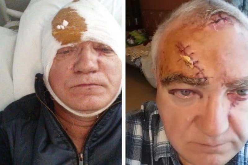 Мужчина получил битой по голове в Ленинском из-за своей бдительности