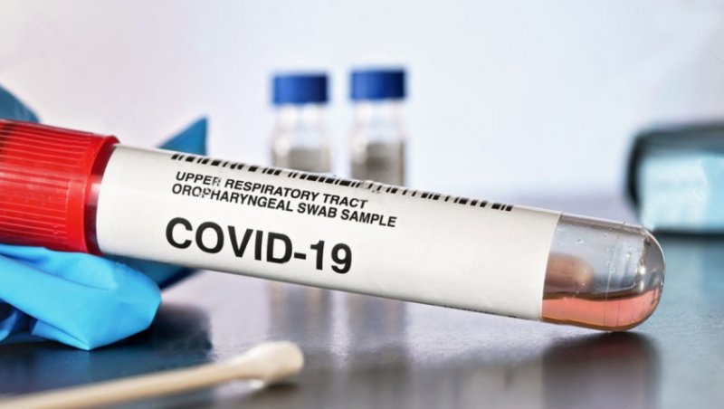 Еще 646 случаев Covid‑19 выявили в Московской области за сутки