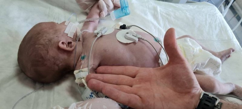 Врачи в Химках спасли практически бездыханного новорожденного ребёнка