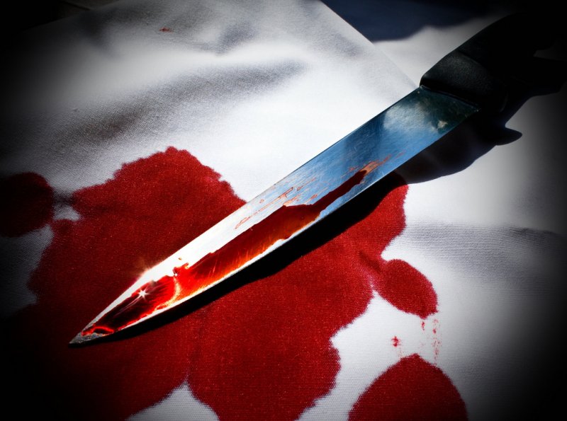 Мужчина получил ножевое ранение в ходе драки в Волоколамске