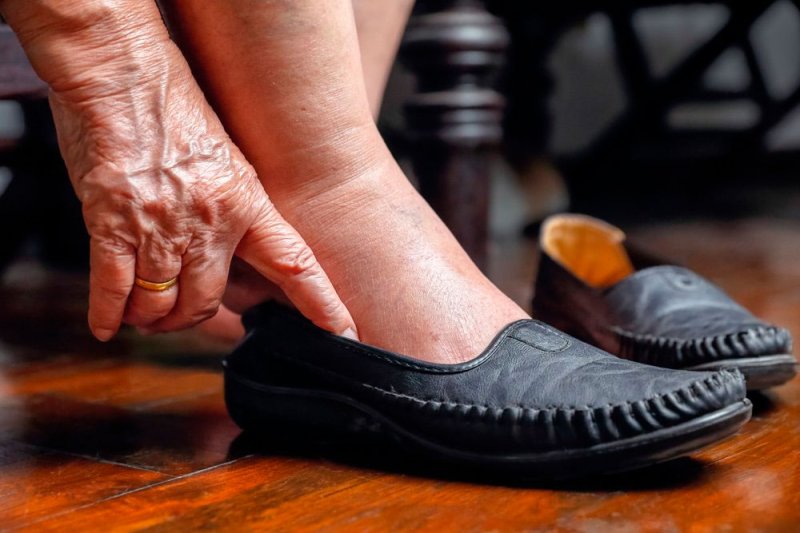 Пенсионерке из Серпухова помогли получить качественную ортопедическую обувь