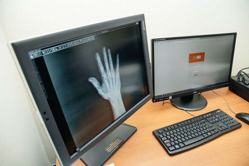 Цифровой рентген-аппарат появился в поликлинике № 4 мкр Клязьма