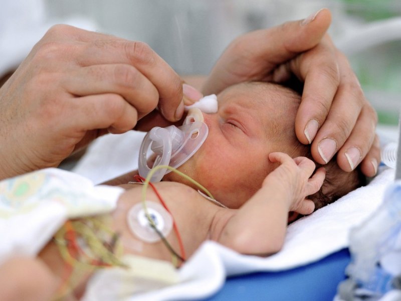 Почти 300 новорожденных весом менее 1000 г спасли подмосковные врачи в прошлом году