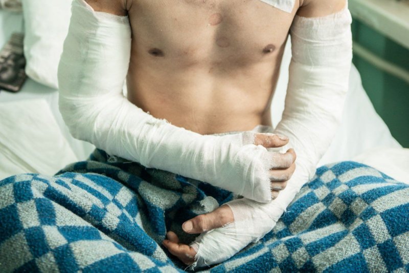 В Солнечногорске врачи спасли молодого мужчину, которому практически отрезало руки упавшим стеклом