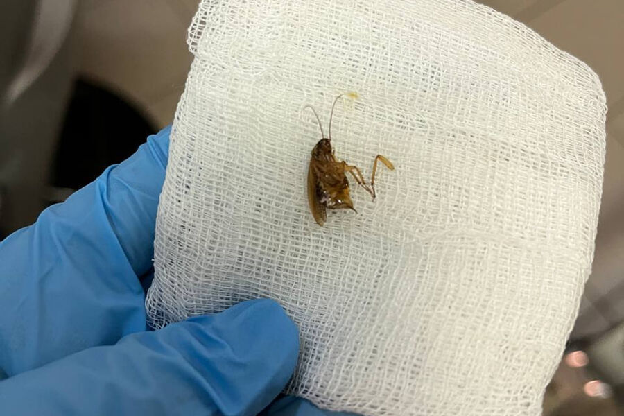 Врачи Видного достали из уха пациентки живого таракана: видео