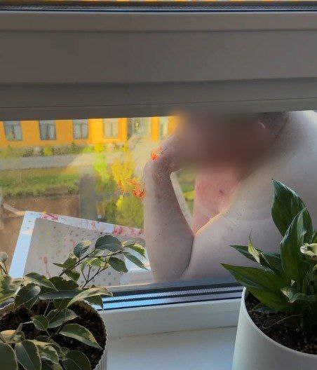 В Красногорске голый и пьяный мужчина  упал из окна на кондиционер соседей снизу