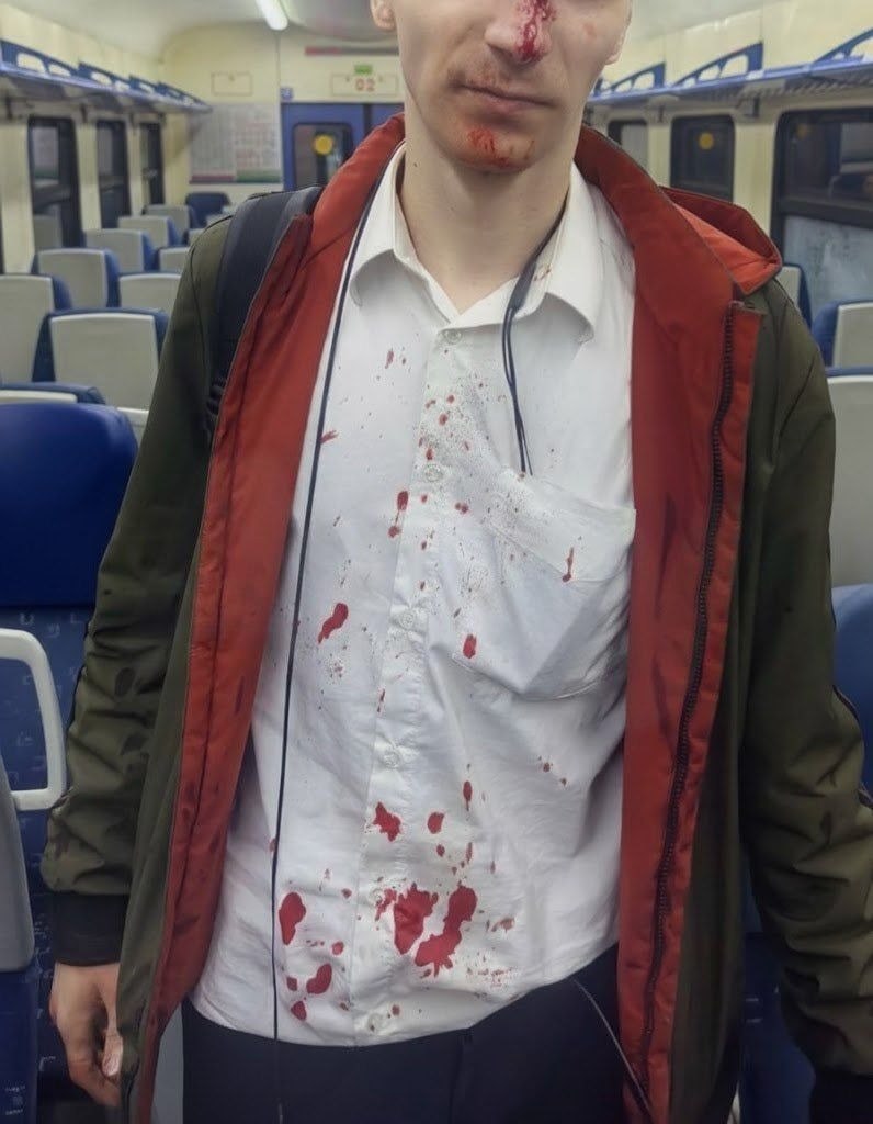 В Подмосковье подростки разгромили электричку и напали на машиниста