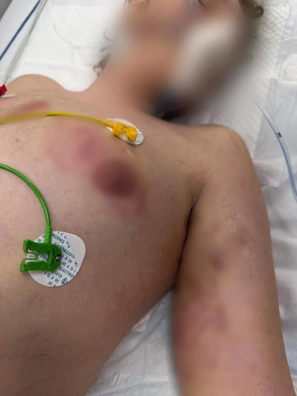 В Истре задержан администратор рехаба, в котором издевались над детьми